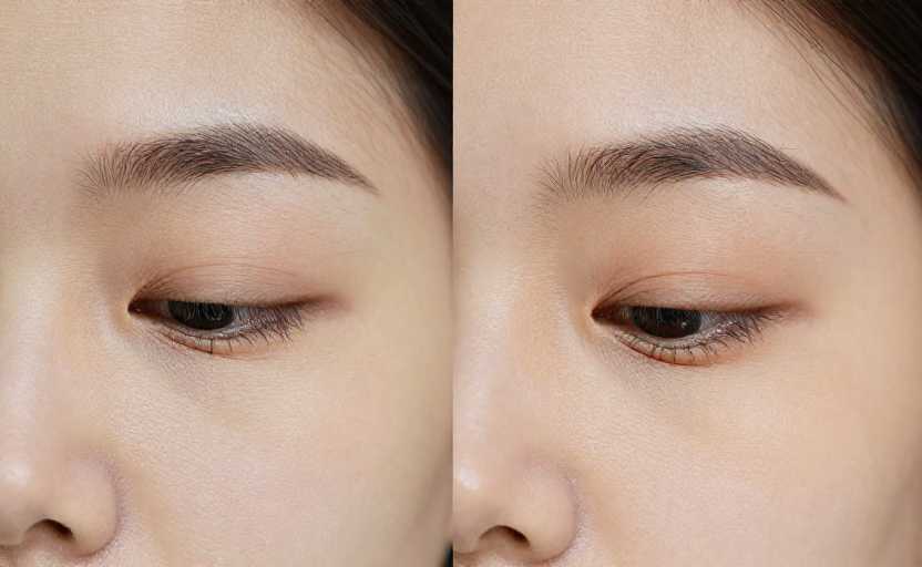 In winter, the elderly may wish to eat some sour food